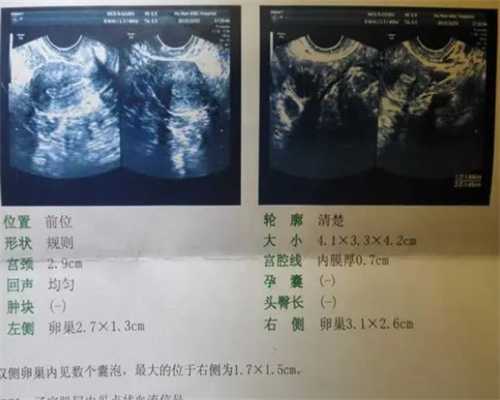 上海生殖代孕医院排名,上海长海医院试管婴儿成功率能达到50%吗？